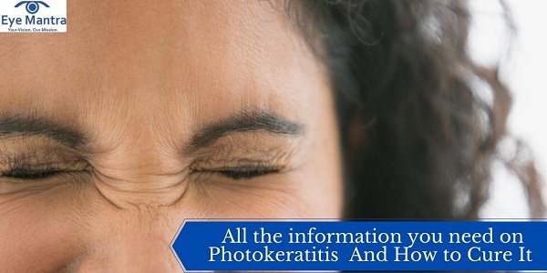 All the information you need on Photokeratitis and How to Cure It