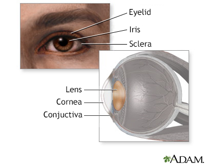 diagnosis of eye with slit lamp