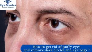 How to get rid of puffy eyes