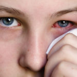 eye problems symptoms