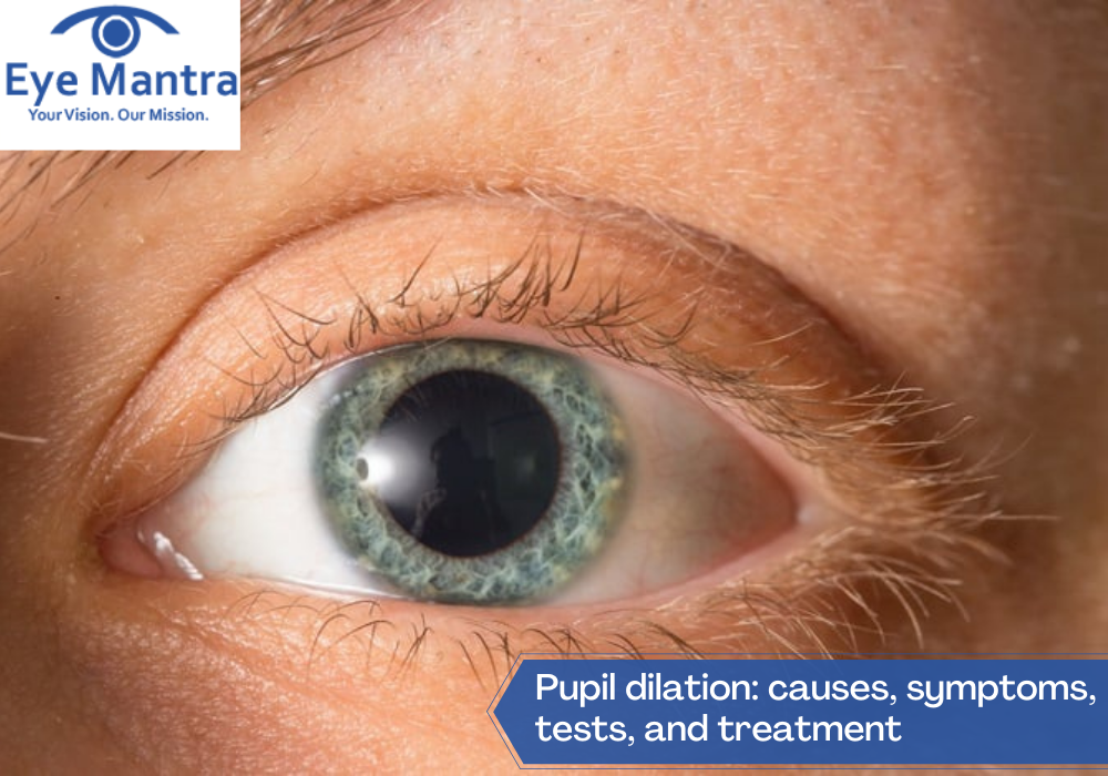 Pupil dilation: causes, symptoms, tests, and treatment