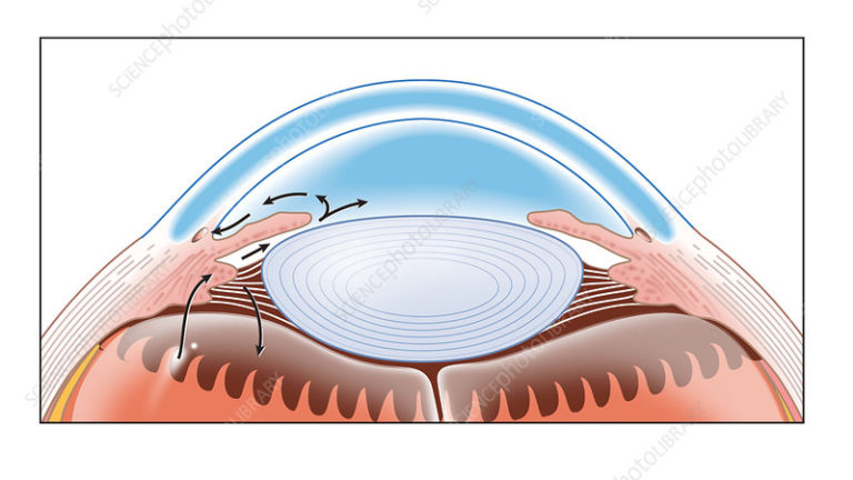 aqueous-humor-structure-production-function-and-drainage