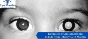 Definition of Anisometropia: In kids from Infancy to 18 Months