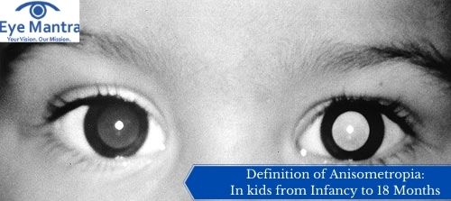 Definition of Anisometropia: In kids from Infancy to 18 Months