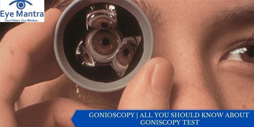 GONIOSCOPY | ALL YOU SHOULD KNOW ABOUT GONISCOPY TEST