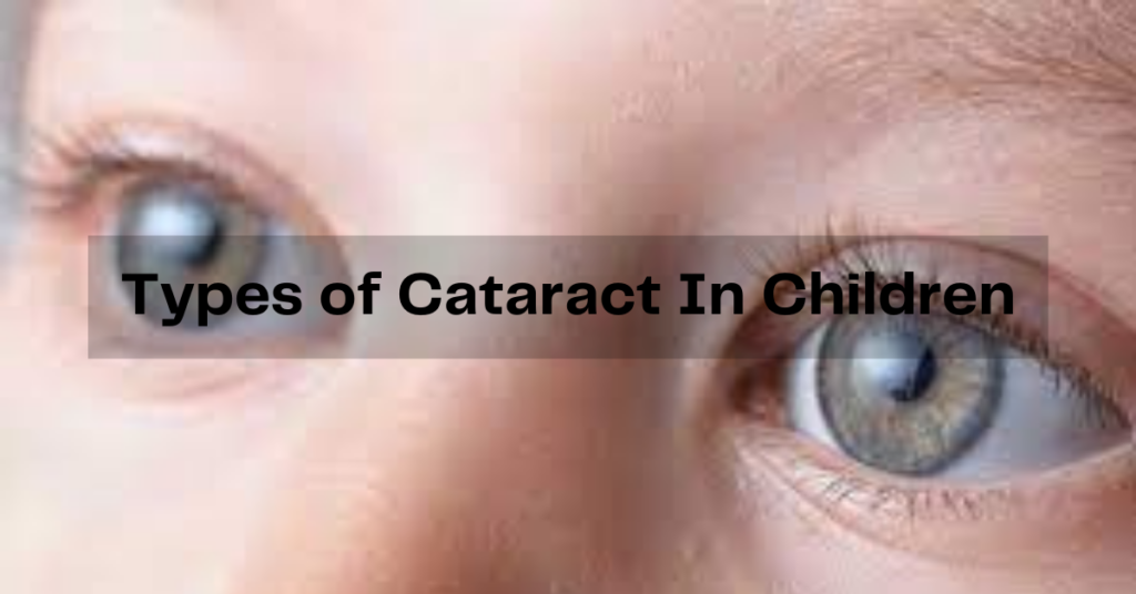 Types of Cataract In Children