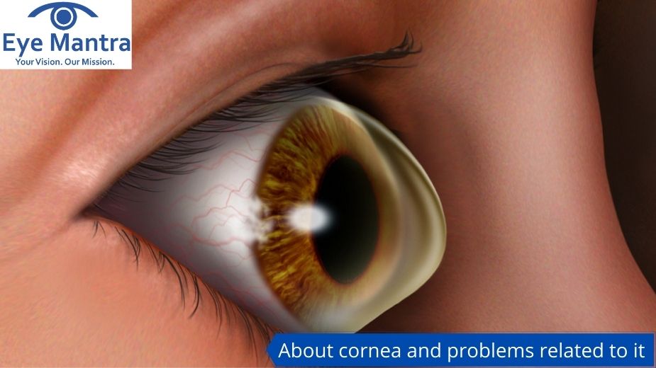 About cornea and problems related to it