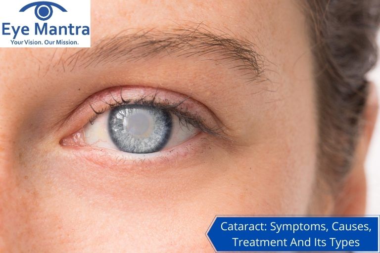 Cataract Symptoms, Causes, Treatment And Its Types