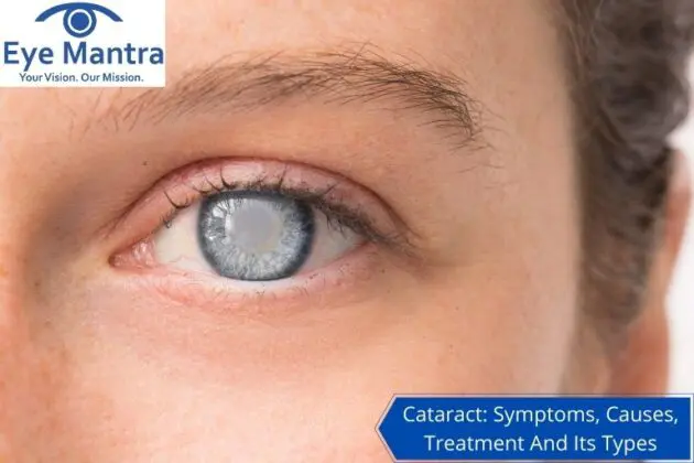 Cataract Symptoms, Causes, Treatment And Its Types