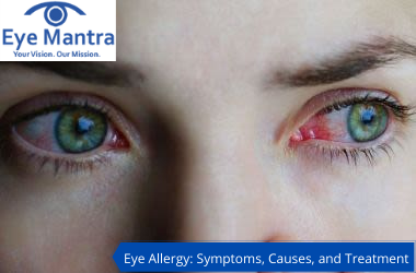 Eye Allergy_ Symptoms, Causes, and Treatment