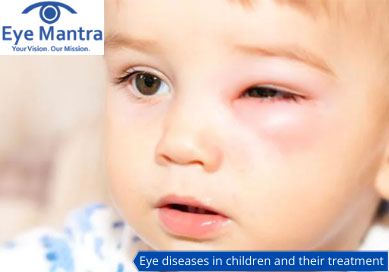 Eye diseases in children and their treatment