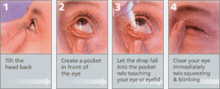 Antibiotic Eye Drops