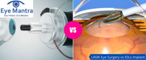 LASIK vs IOL