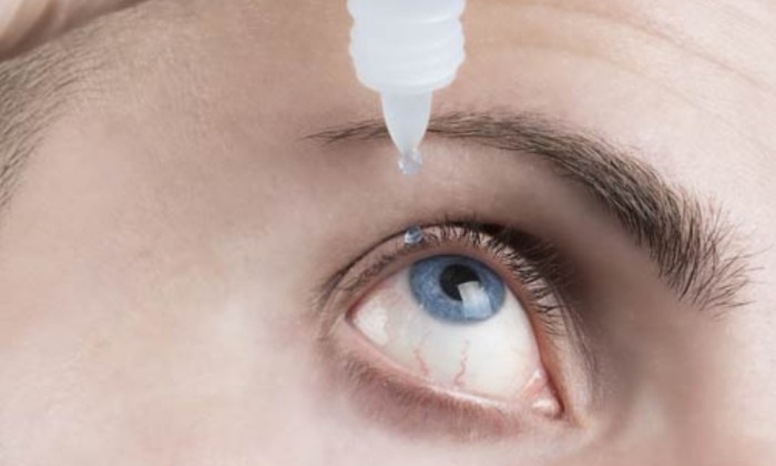Treatment for eye allergies