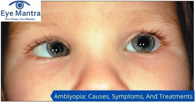 Amblyopia