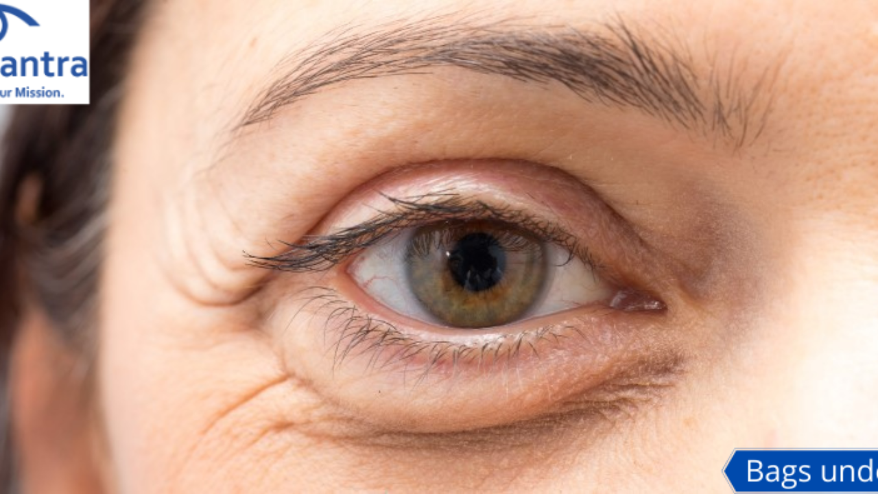 2x Brightening Under Eye Cream -Remove Dark Circles Eye Bags Wrinkles Puffy  Eyes | eBay