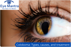 Coloboma Types, causes, and treatment