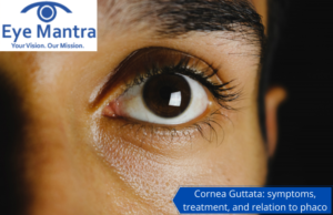 Cornea Guttata
