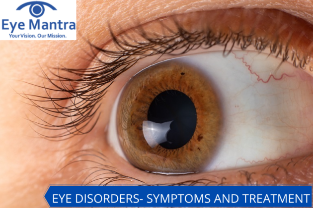 EYE DISORDERS