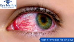 Home remedies for pink eye