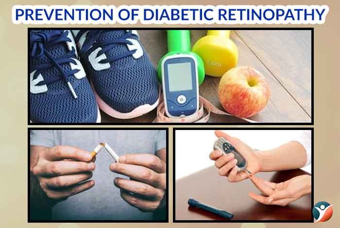 Preventions of Diabetic Retinopathy