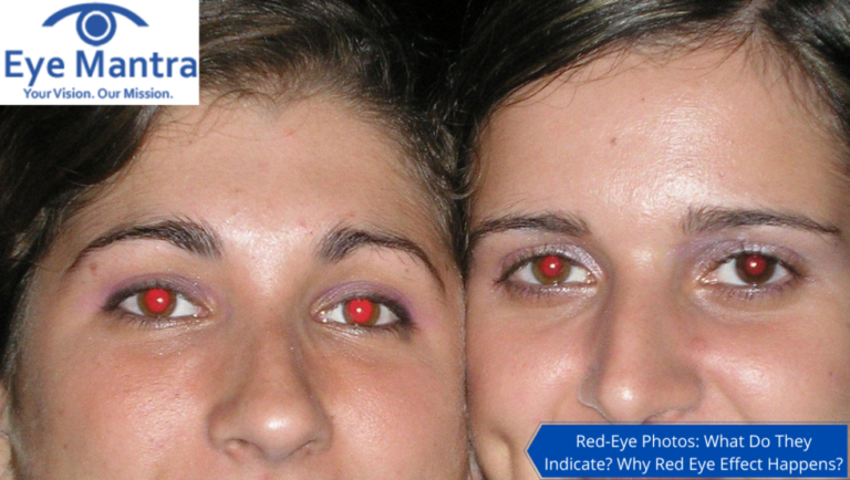 Red Eye Effect What Do They Indicate What Causes Red Eye In Photos