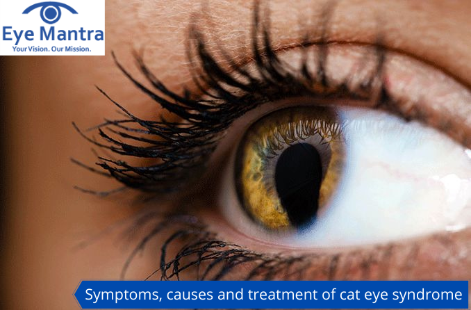 Symptoms, causes and treatment of cat eye syndrome