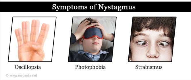 Symptoms of Nystagmus