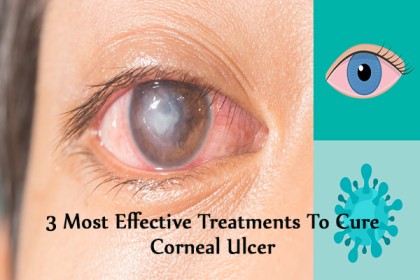 Treatment of Corneal Ulcers