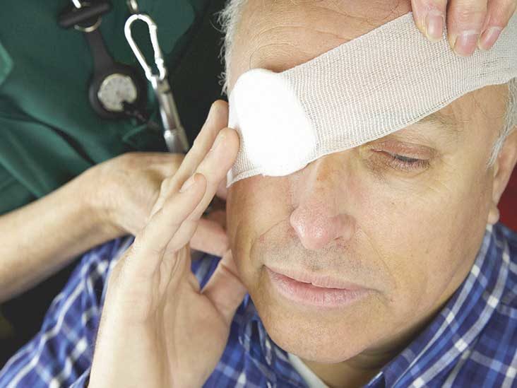 Treatment of an eye socket fracture