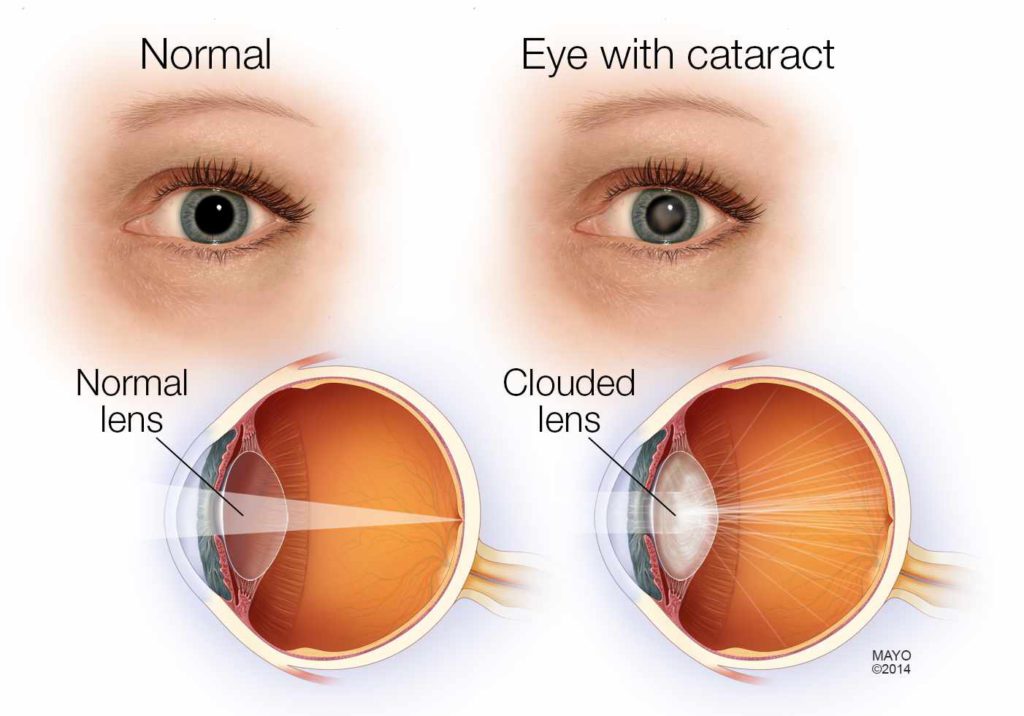 eye anatomy
