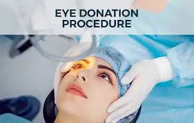 eye donation proedure
