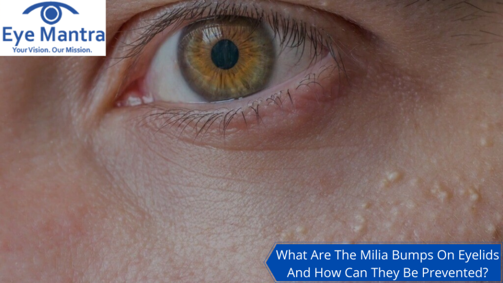 Milia Bumps on Eyelids | Home Remedies For Eyelid Bumps