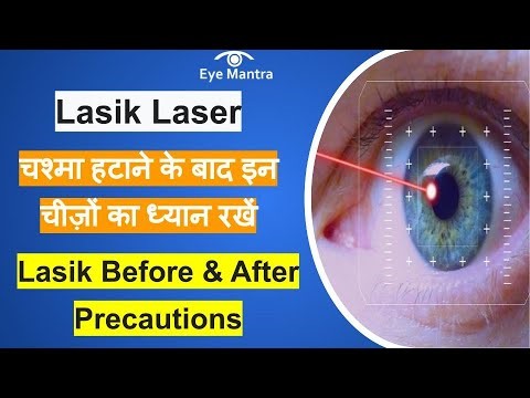 laser lasik