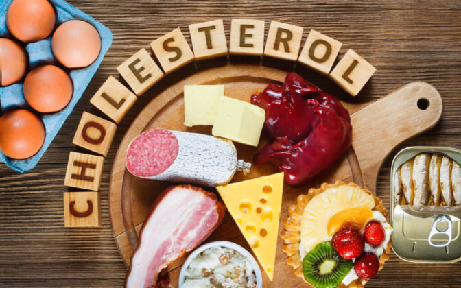 High cholesterol