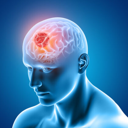 Rise in brain pressure