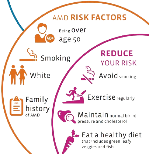 amd-risk-factors-prevention