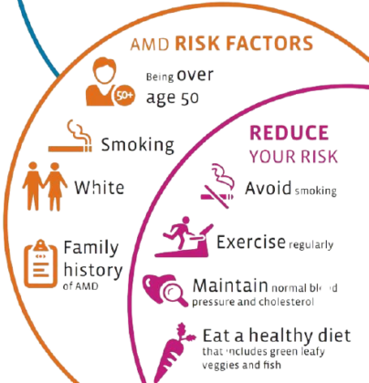 amd-risk-factors-prevention