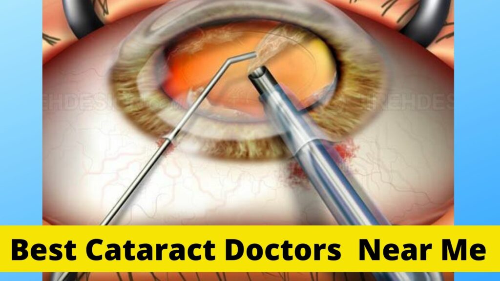 Best Cataract Doctors Near Me