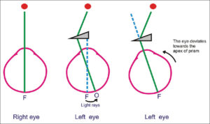 Working of prism in Eye glasses