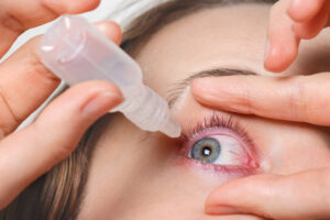 Post-LASIK care: What Is It, And Tips For Post-LASIK Care