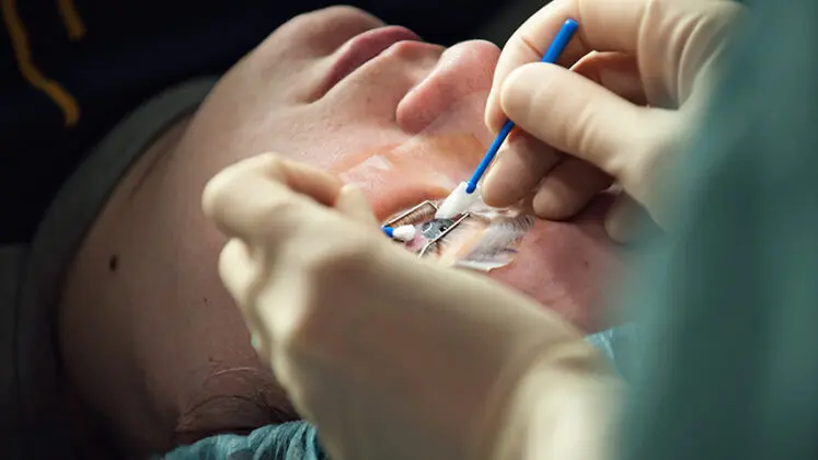 Procedure For LASIK Surgery