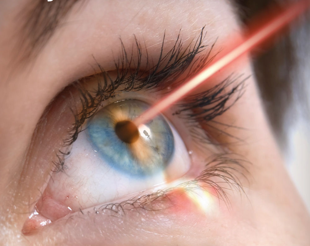 What Is Contoura Vision : Types, Benefits And Side-Effects