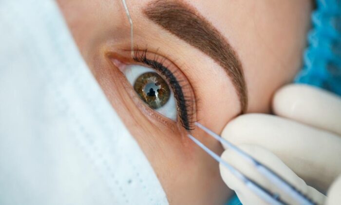 The Flap LASIK Procedure What to Expect