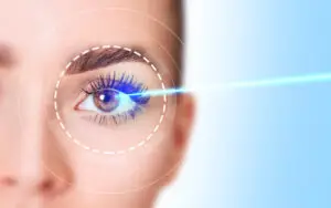 Benefits of LASIK for Cylindrical Power
