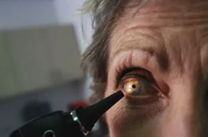 Understanding the Cataract Lifecycle