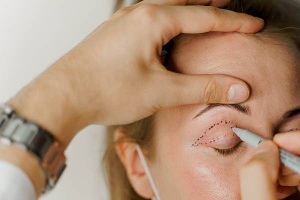 Effective Treatments for Bags Under Eyes