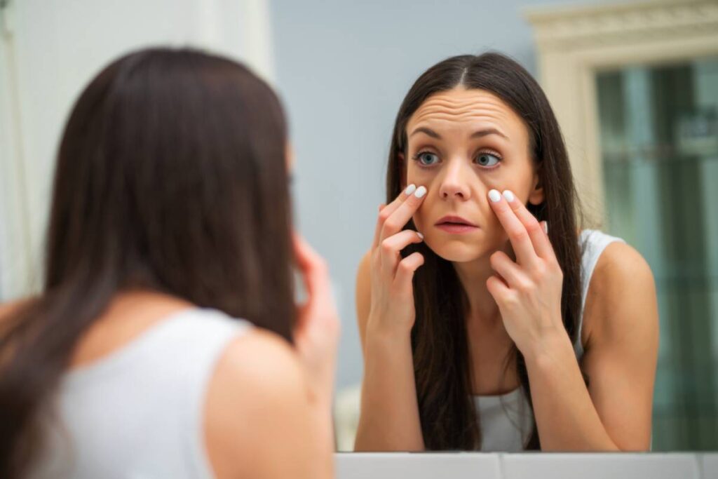 How to Avoid Getting Bags Under Your Eyes