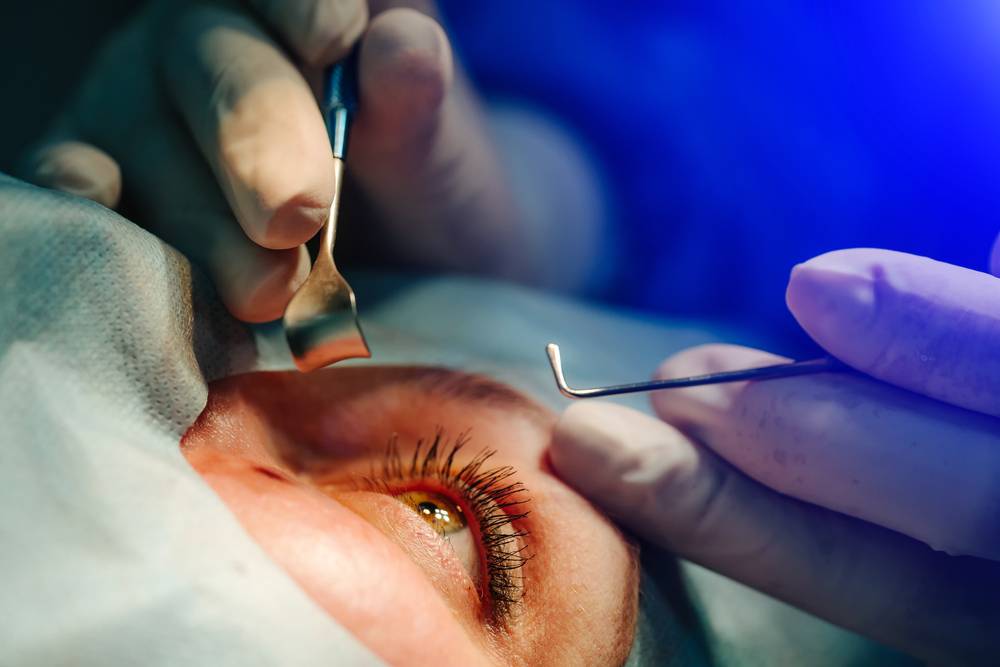 Best Eye Surgeries for Thin Corneas
