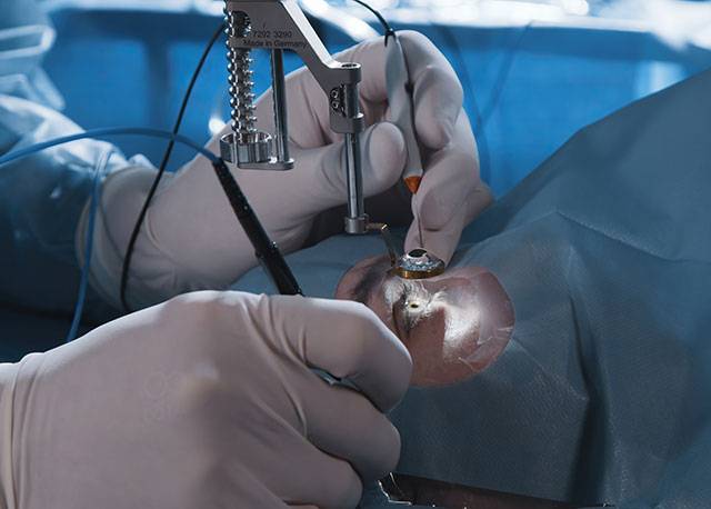 Top Flapless Surgery Options for Specs Removal in 2025